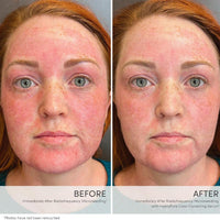 HydroPure Color Correcting Serum - Skin / Scent