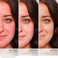 Thumbnail for HydroPure Color Correcting Serum - Skin / Scent