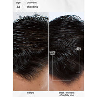 FutureIQ™ Biomimetic Hair Longevity Serum (90 ml)