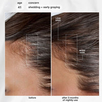 FutureIQ™ Biomimetic Hair Longevity Serum (90 ml)