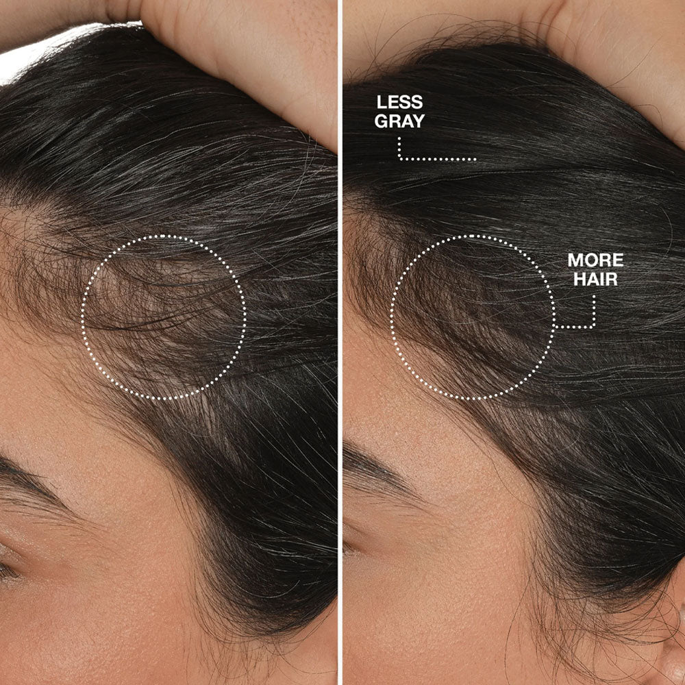 FutureIQ™ Biomimetic Hair Longevity Serum (90 ml)