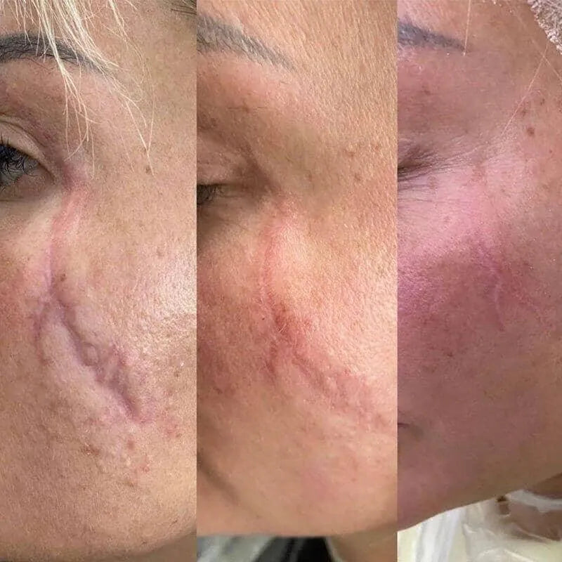 COLD PLASMA - Skin / Scent