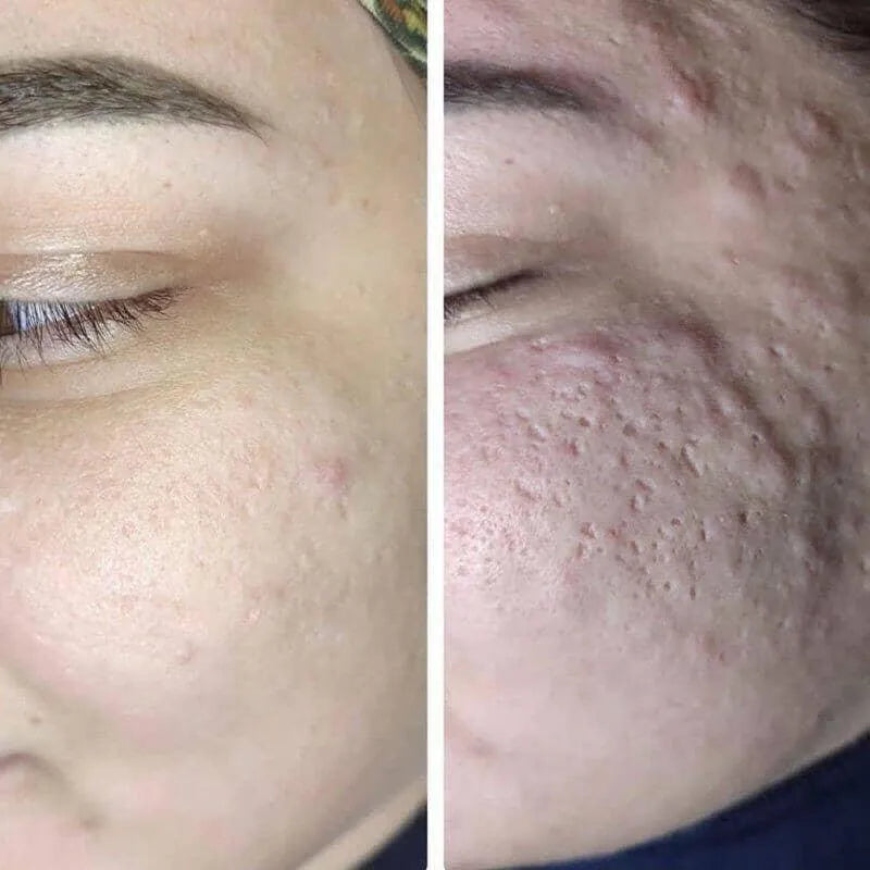 COLD PLASMA - Skin / Scent