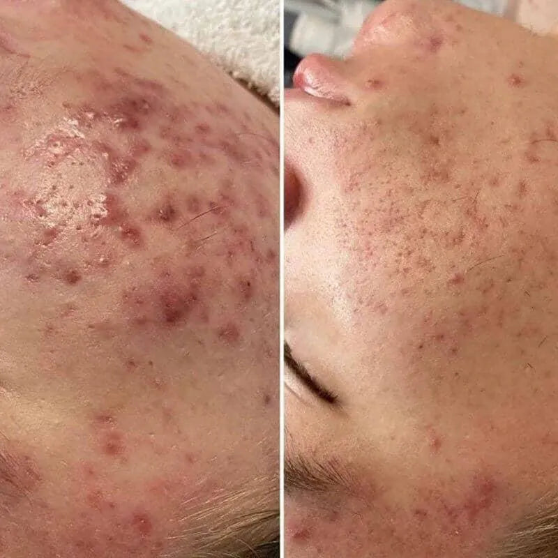 COLD PLASMA - Skin / Scent