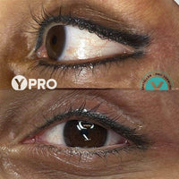 PMU of tatoeage verwijderen - Skin / Scent