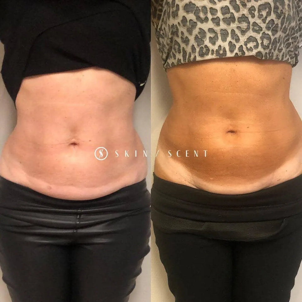 Vetbevriezen - Skin / Scent